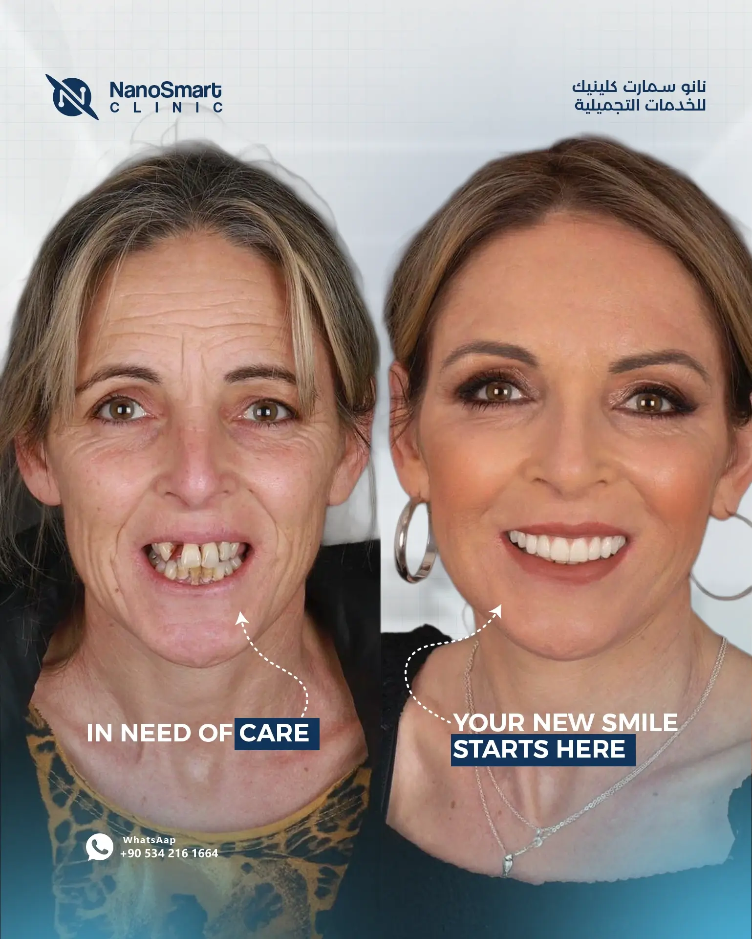 before after-1 copy (1)