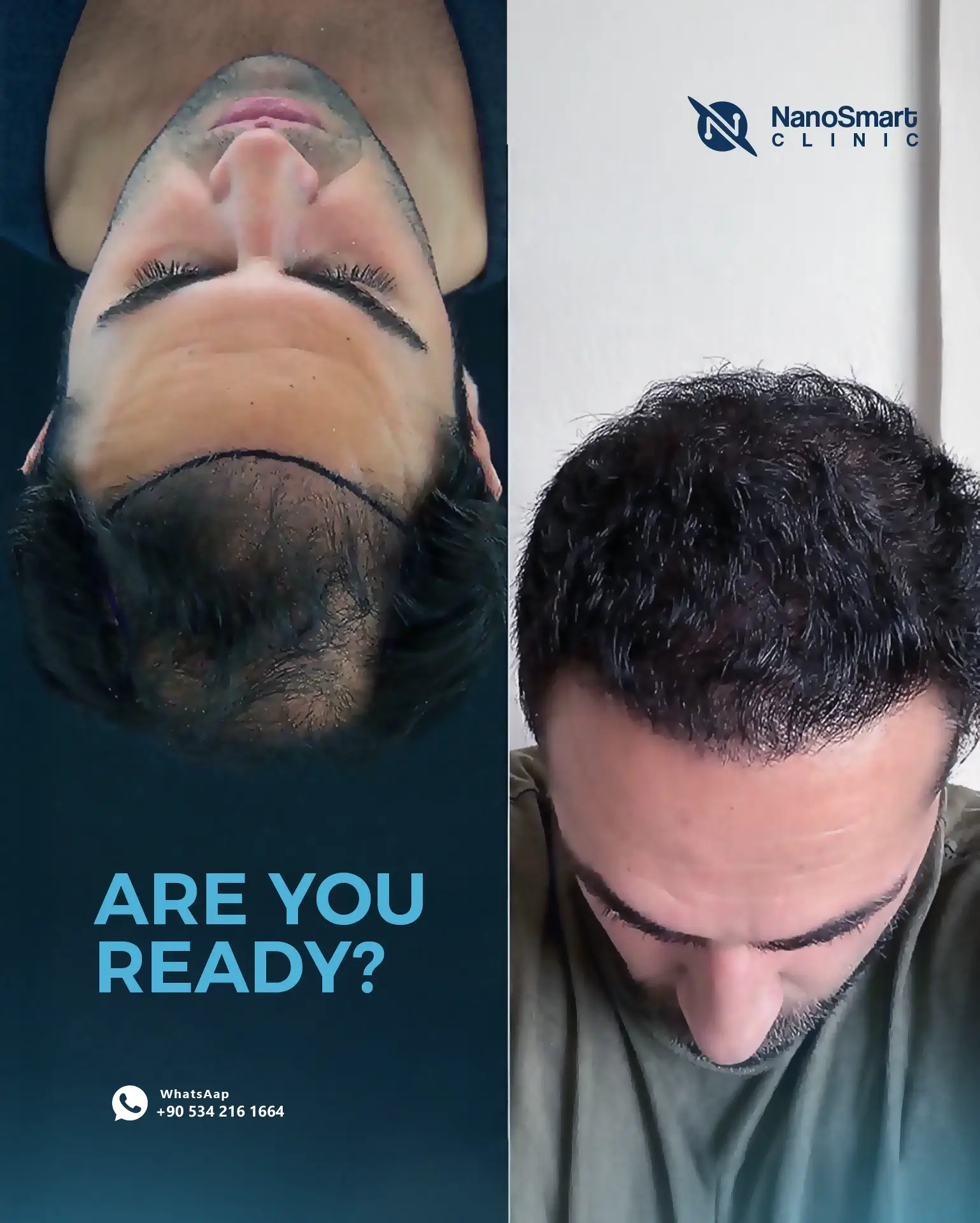 before after-3 copy (1)